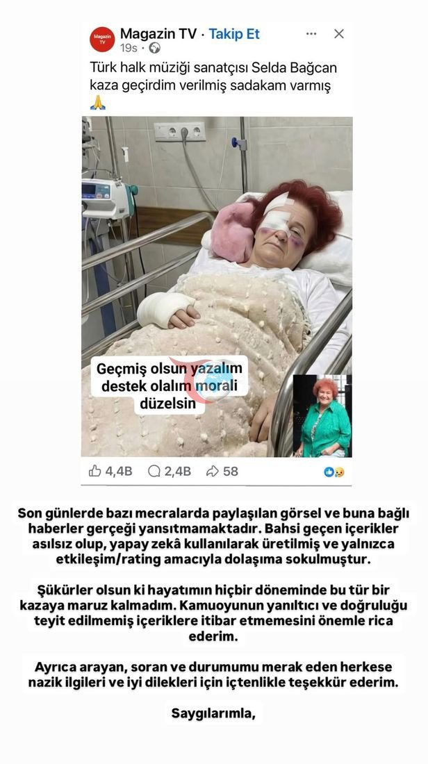 Selda Bağcan kaza mı geçirdi? Flaş açıklama