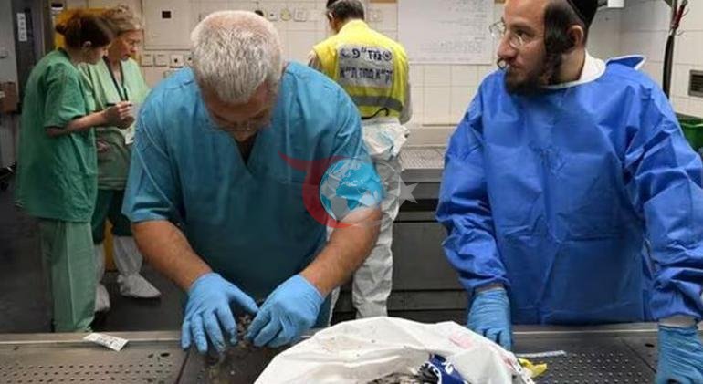 Dünyanın en büyük Deri Bankası İsrailde Kardeşlerimin cesetlerini yüzüyorlar