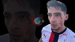 Amatör futbol maçında kavga çıktı, 3 futbolcu hastanelik oldu