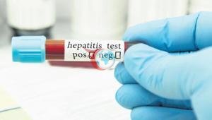 Hepatitte riskli nüfus taranacak
