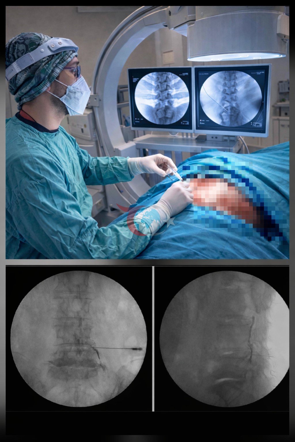 Ezine’de bel fıtığına ameliyatsız modern tedavi