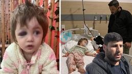 Yalovaโda 14 aylฤฑk bebeฤi hastanelik ettiler! ฤฐddialarฤฑn odaฤฤฑndaki komลu konuลtu