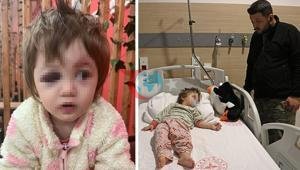 Yalovada 14 aylık kızı ile birlikte darbedilen babadan yeni açıklama