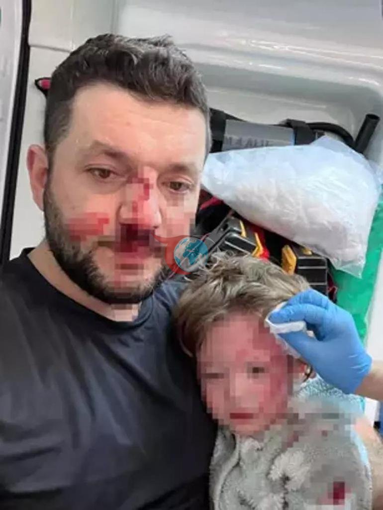 İçişleri Bakanlığı, Yalova’da baba ve 14 aylık bebeğine darp olayıyla ilgili harekete geçti