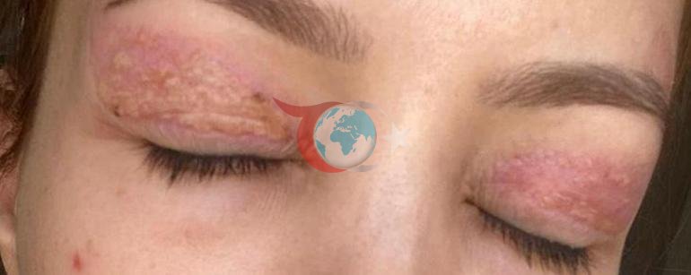 Güzellik salonunda bin 100 liralık işlem hayatını karatttı: Bunu acı bir şekilde öğrenmiş oldum