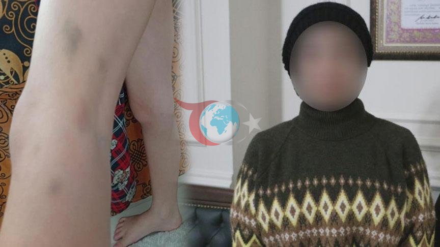 Anne ve Baba Arasındaki Velayet Çatışması: Mahkeme Kararına İtiraz