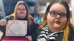 Kilosu nedeniyle zorbalık gördü, psikoloji okudu: Sıralara oturamıyordum