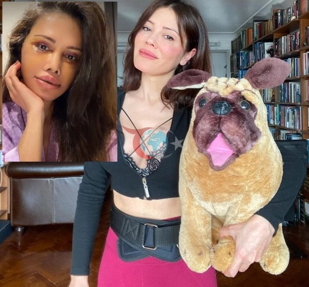 Yüz nakli yaptıran Didem Ceran: "Yüzü nakledilen kişinin alnı kaşıma denk geldi"