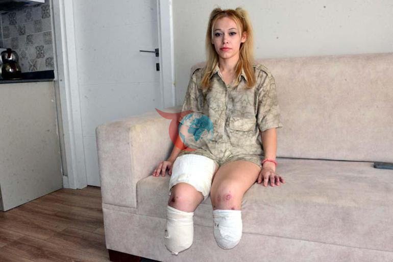 En mutlu gününde iki bacağını kaybetti İsyan ettiren son