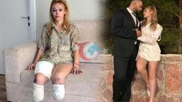 Fitness eğitmeni en mutlu gününde 2 bacağını kaybetti! ‘Evlilik yıl dönümüm cehenneme döndü’