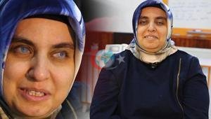 Çevresini silüet olarak gören kadının ilham veren hikayesi: Harika bir şey benim için