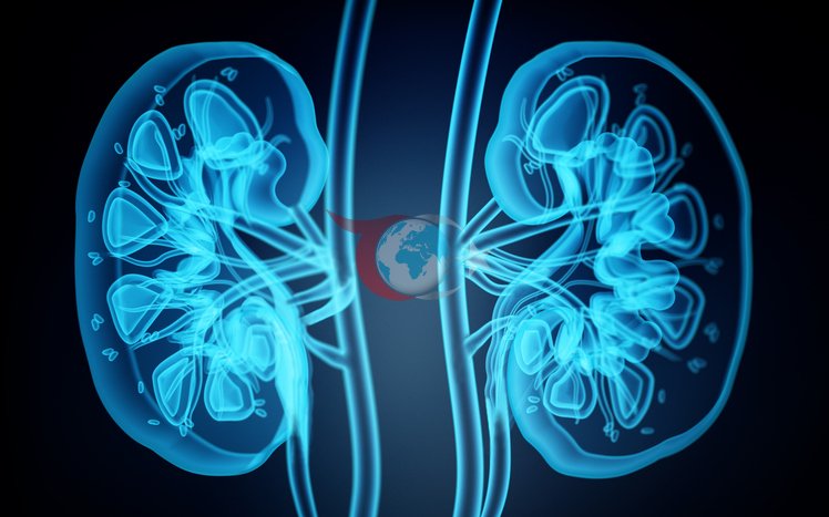 Böbrek Taşları Böbrek Kaybına Yol Açabilir!