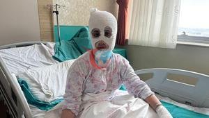 İftar vakti düdüklü tencere faciası ‘Yüzüme elimi sürdüm, et parçası geliyordu