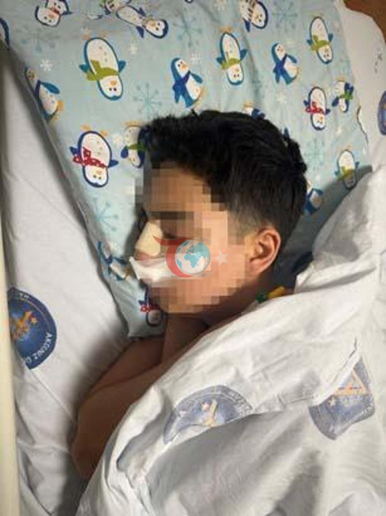 Akran zorbalığı kamerada Hiç tanımadıkları gencin yanına gelip burnunu kırdılar