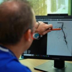 Uzman isim dikkat çekti: 2050'de 3 milyon kişi uzvunu kaybedebilir 