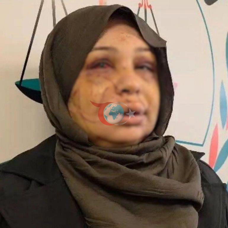 Eşinin yüzünü 60 dikiş atıldı Kendini böyle savundu: Ben büyük bir aile katliamını önledim