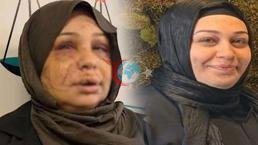 Eşinin yüzünü 60 dikiş atıldı! Kendini böyle savundu: Ben büyük bir aile katliamını önledim
