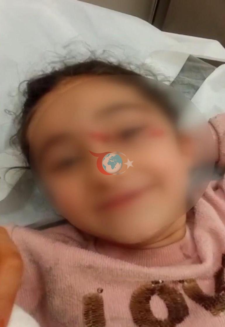 İstanbulda sokak köpeği kabusu: Çocuklarımızı tek başına evden çıkaramıyoruz