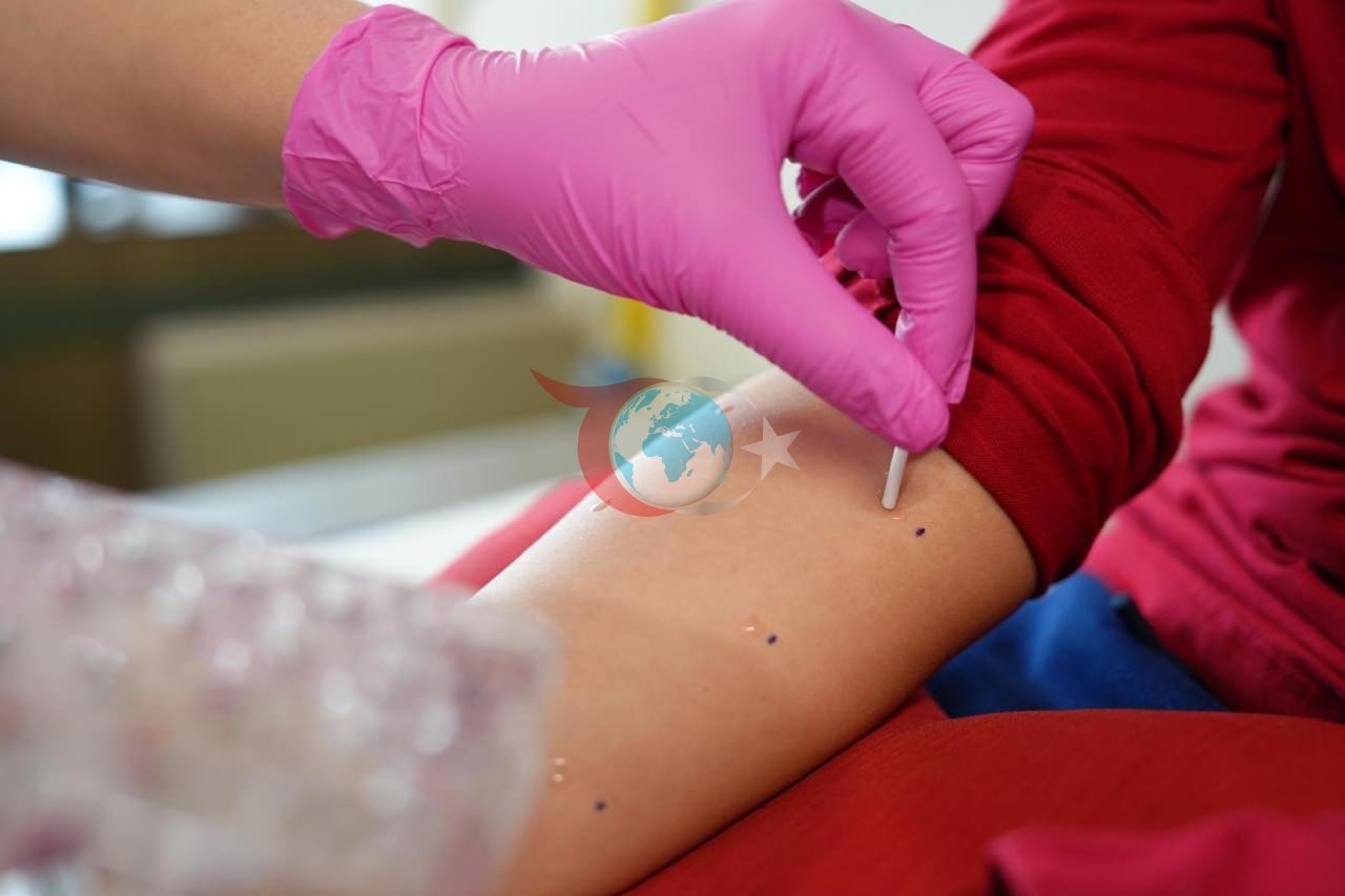 Polen alerjisi alarmı verildi.