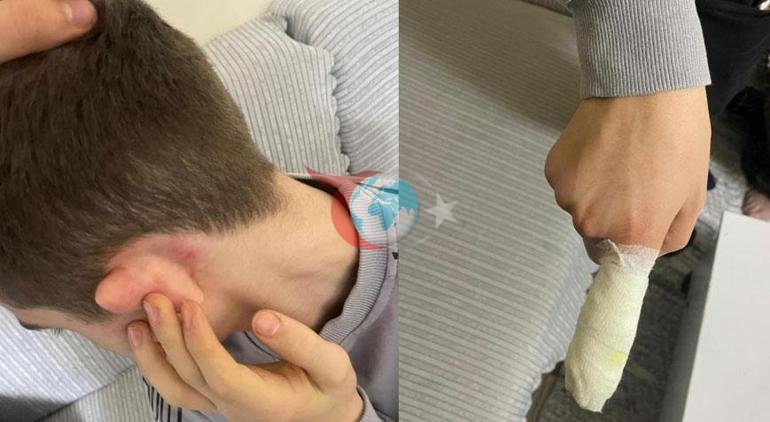 14 yaşındaki çocuk dehşeti yaşadı Ekmek almaya çıktı, hastanelik oldu
