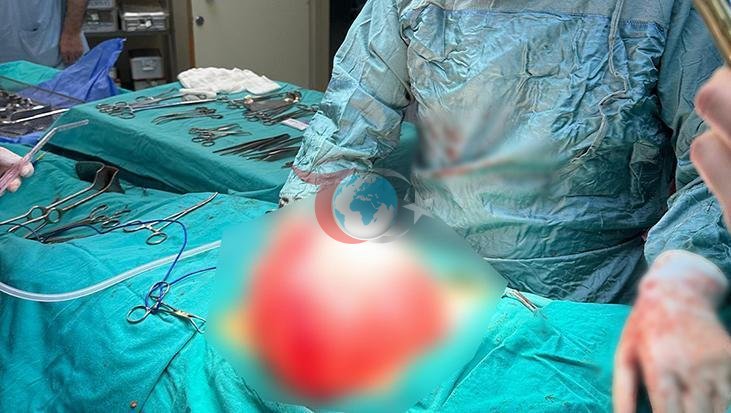 14 Yaşındaki Öğrencinin Karın Bölgesinden Çıkan Şaşırtıcı Kist