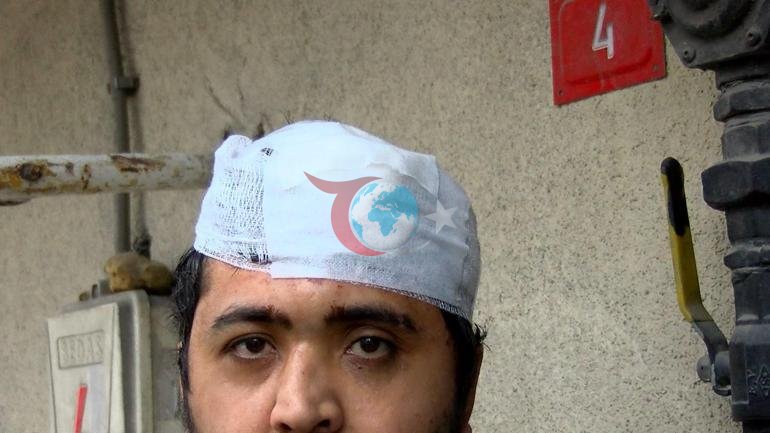 Zihinsel engelli ve annesine sopalı saldırı Sen deli Kadirsin diyorlar