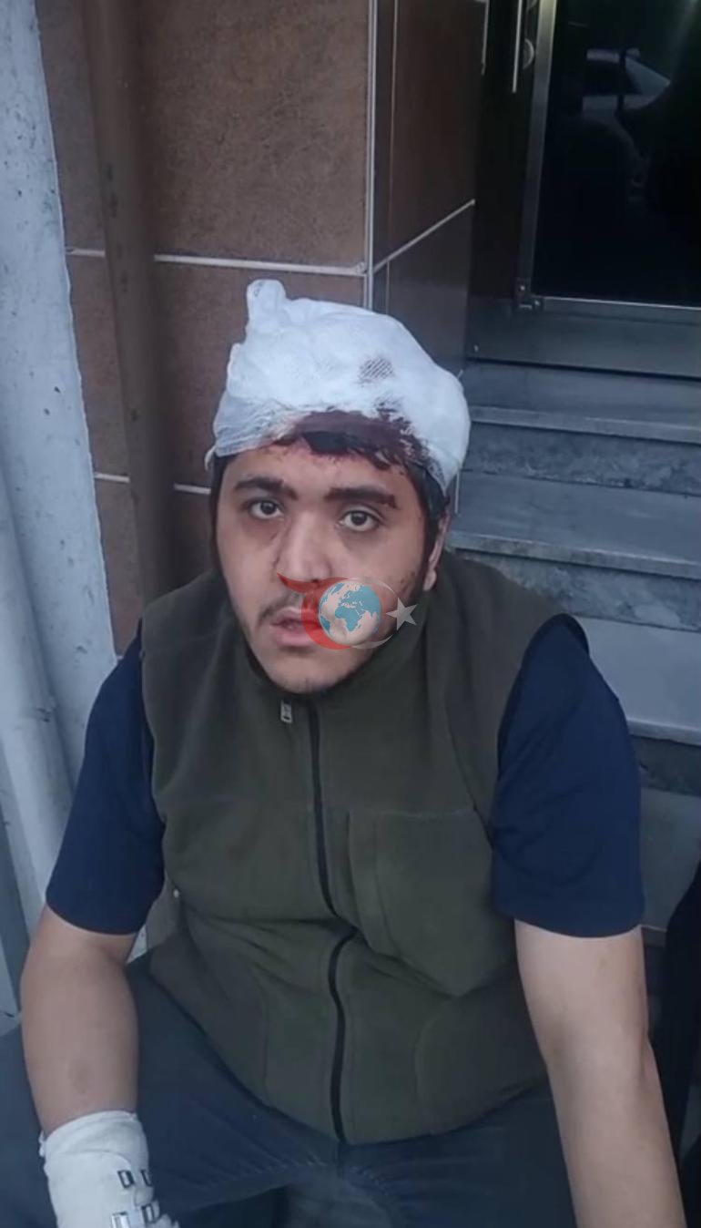 Zihinsel engelli ve annesine sopalı saldırı Sen deli Kadirsin diyorlar