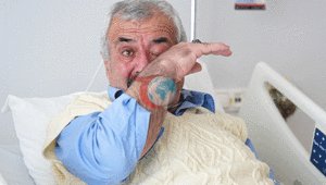 4 yıldır geçmeyen hıçkırık Ne yemek yiyebildi ne de uyuyabildi
