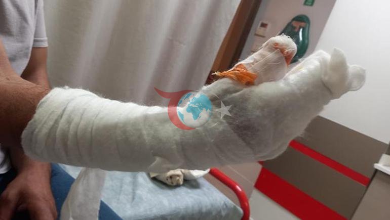Kocaeli’de skandal iddia: Tedavi sonrası parmağı ampute edildi, kolunda metal bulundu