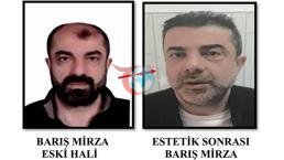 Ameliyat ile yüzünü değiştiren firari 7 yıl sonra yakalandı
