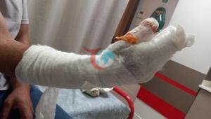 Kocaeli’de skandal iddia: Tedavi sonrası parmağı ampute edildi, kolunda metal bulundu