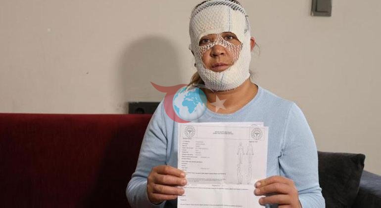 7 bin liralık ‘Prenses cilt bakımı’ kabusu: Oğlum beni görünce öcü diyerek kaçtı