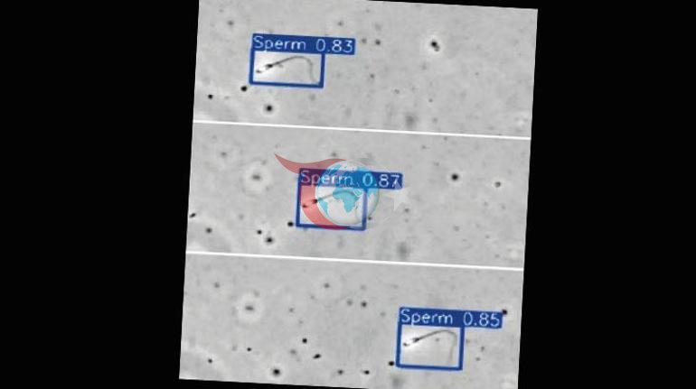 Gizli sperm avcısı