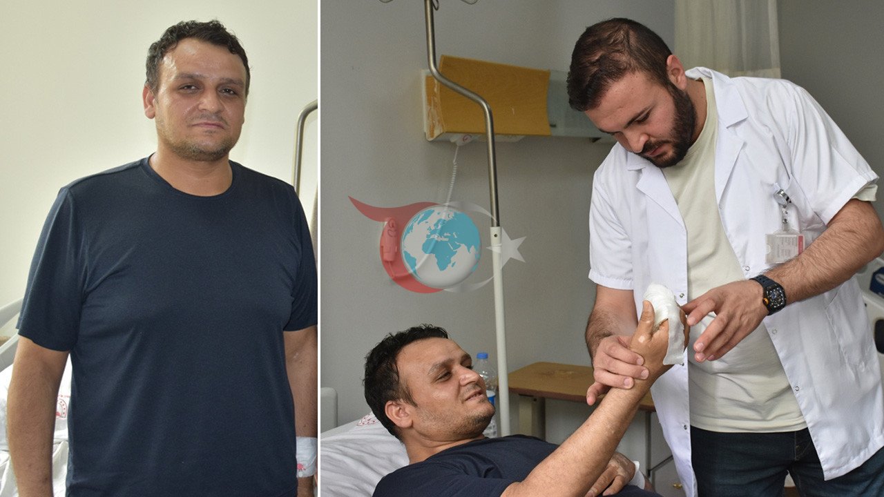 Enfeksiyonlu Parmak Kasık Yöntemiyle Ameliyattan Kurtarıldı