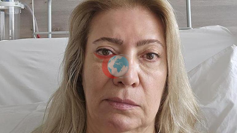 10 dakikada değişim vadi, hayatını karattı Yüzü bu hale geldi