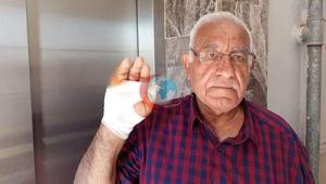 Asansörde korkunç saldırı Komşusu parmağını ısırarak kopardı: Onu çok severdim, niçin yaptı anlamadım