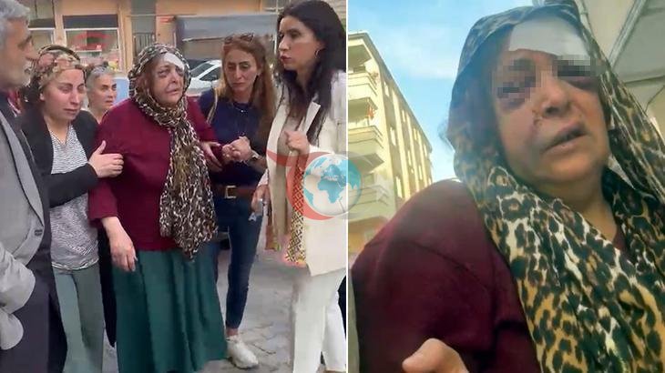 Kayınvalidenin Bıçaklı Müdahalesi Sonrası Serbest Kalması Mahallede Sevinçle Karşılandı