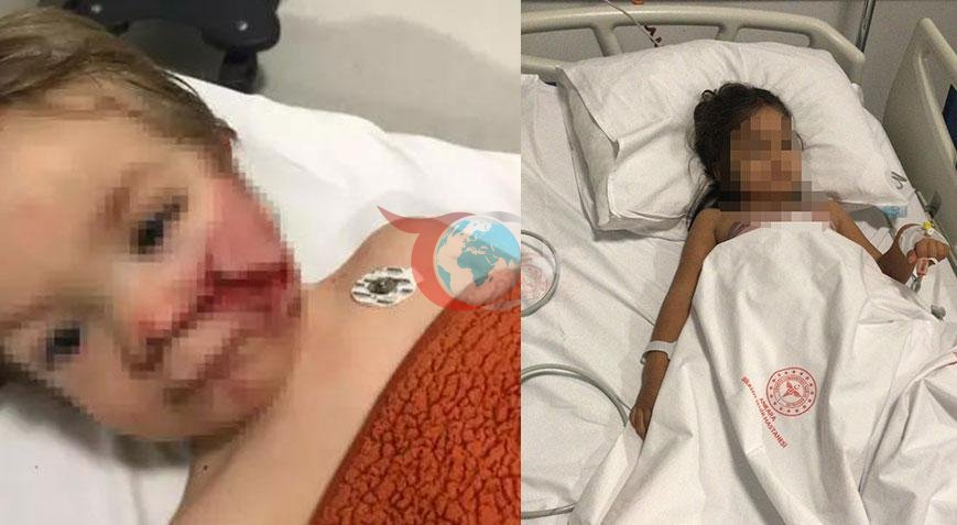 Ankara'da Pitbull Saldırısı: Mahkeme Kararı ve Detaylar