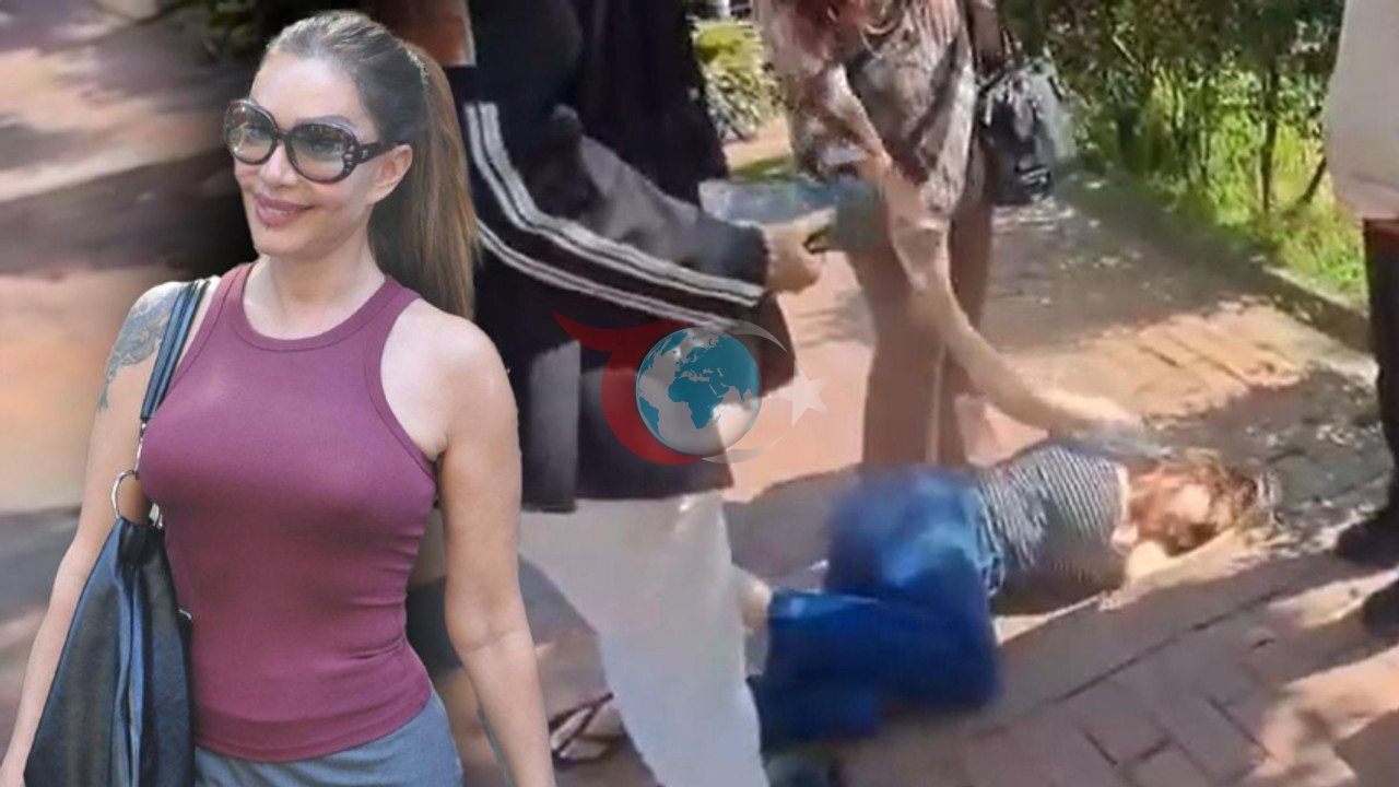 Eski Manken Sevda Demirel Maçka Parkı'nda Kaza Geçirdi