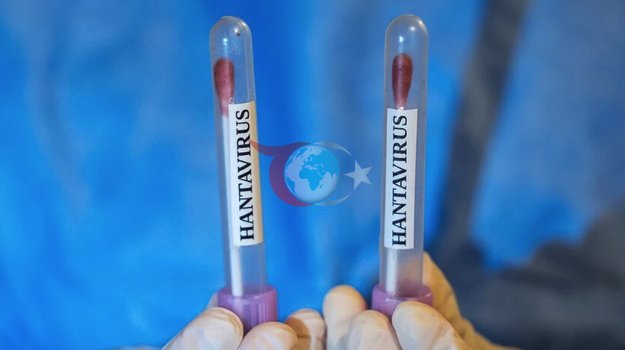 Hantavirus tarqaldi! Jahon sog'liqni saqlash tashkilotining jiddiy ogohlantirishi dunyoni xavotirga solmoqda - Rasm: 02 