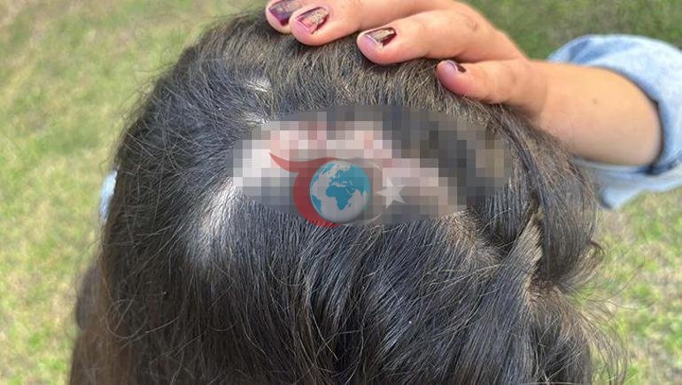 Doktor İremni kaltaklagan sudlanuvchilarga hukm chiqarildi. Ular sochlarini yulib, erga tashlab yuborishdi.