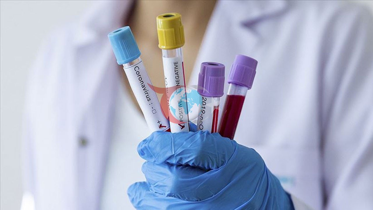 ÜST-nin Ebola epidemiyası üçün Yeni Risk Qiymətləndirilməsi