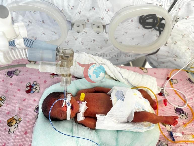Mucize bebek Leyloş, kep ve cübbeyle taburcu oldu: Küçücüktü, tutamadım bile