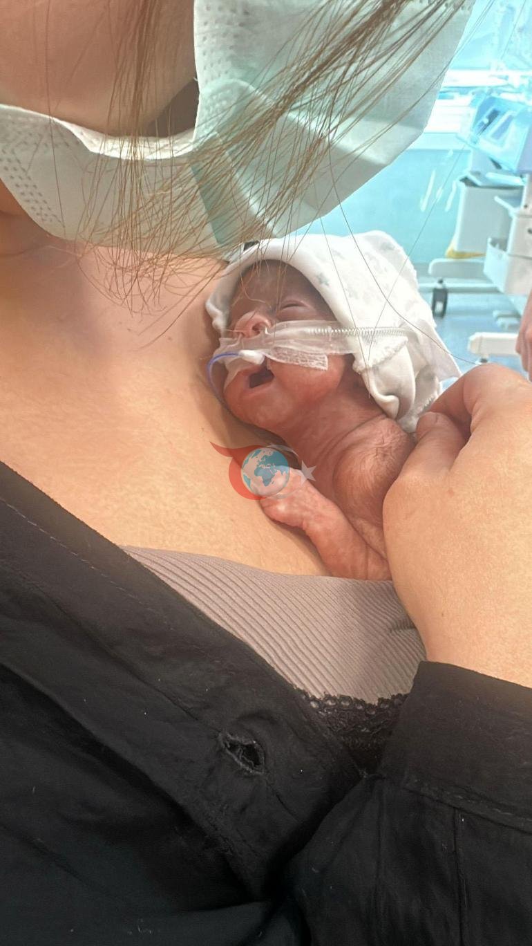 Mucize bebek Leyloş, kep ve cübbeyle taburcu oldu: Küçücüktü, tutamadım bile