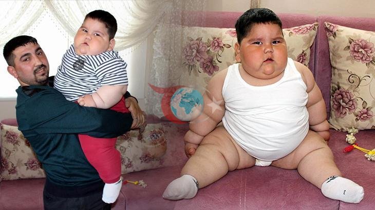 Yağız Bekte'nin İnanılmaz Değişimi: 5 Yaşında 90 Kilodan 40 Kiloya
