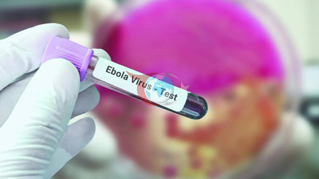 Fransa'da İlk Ebola Vakası: Yetkililer Alarmda
