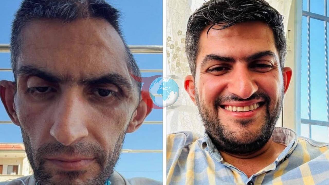 Filistinli Gazetecinin Cezaevi Sonrası Durumu Tepki Çekti