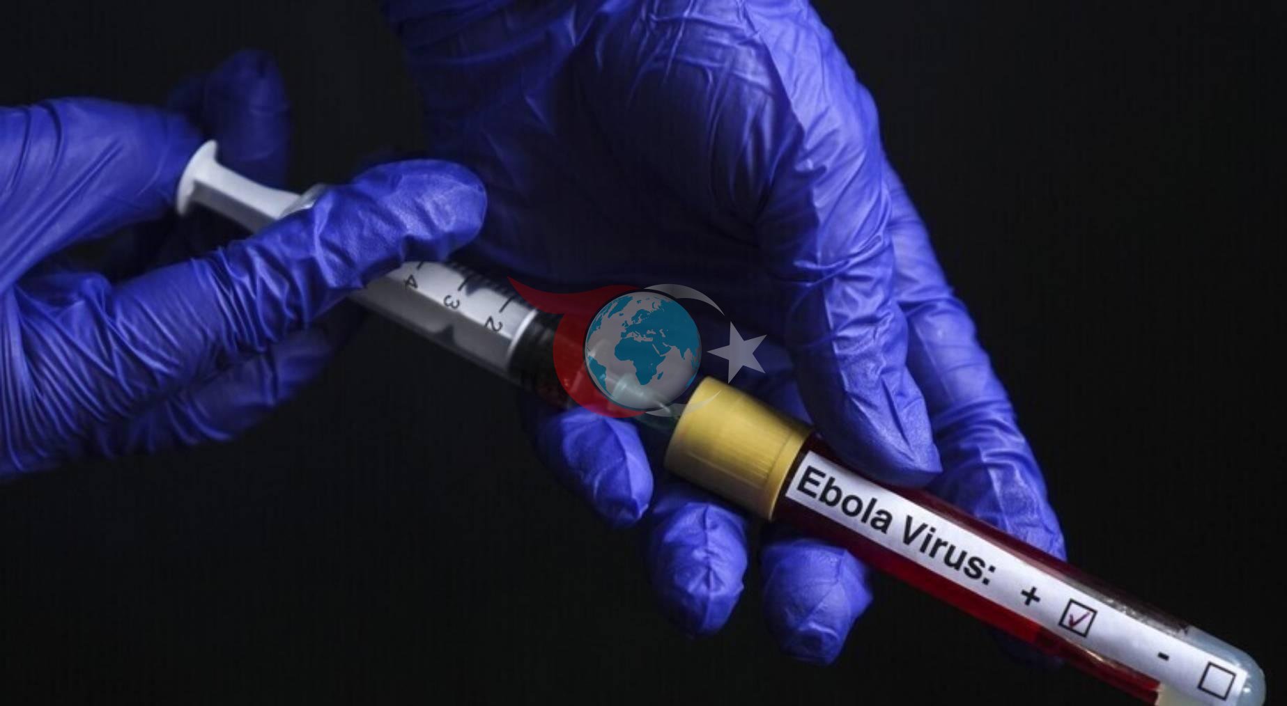 Fransa'da Ebola Vakası: 21 Günlük İzolasyon Başladı