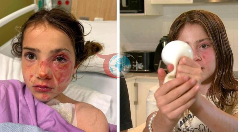 Yeni çılgınlık... İnternette görüp mikrodalgaya attı, dehşeti yaşadı ‘Sanki cildim eriyordu’