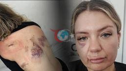 'Bugün büyük gün' diyerek aradı! Dehşeti anlattı: Şanslıydım ki bıçak sırtımda kırıldı